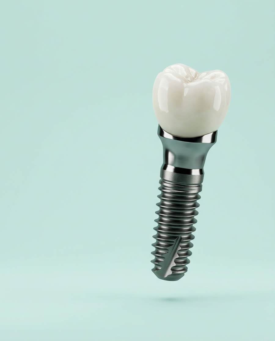 Zirkonyum dişi ile tek parça implant modeli